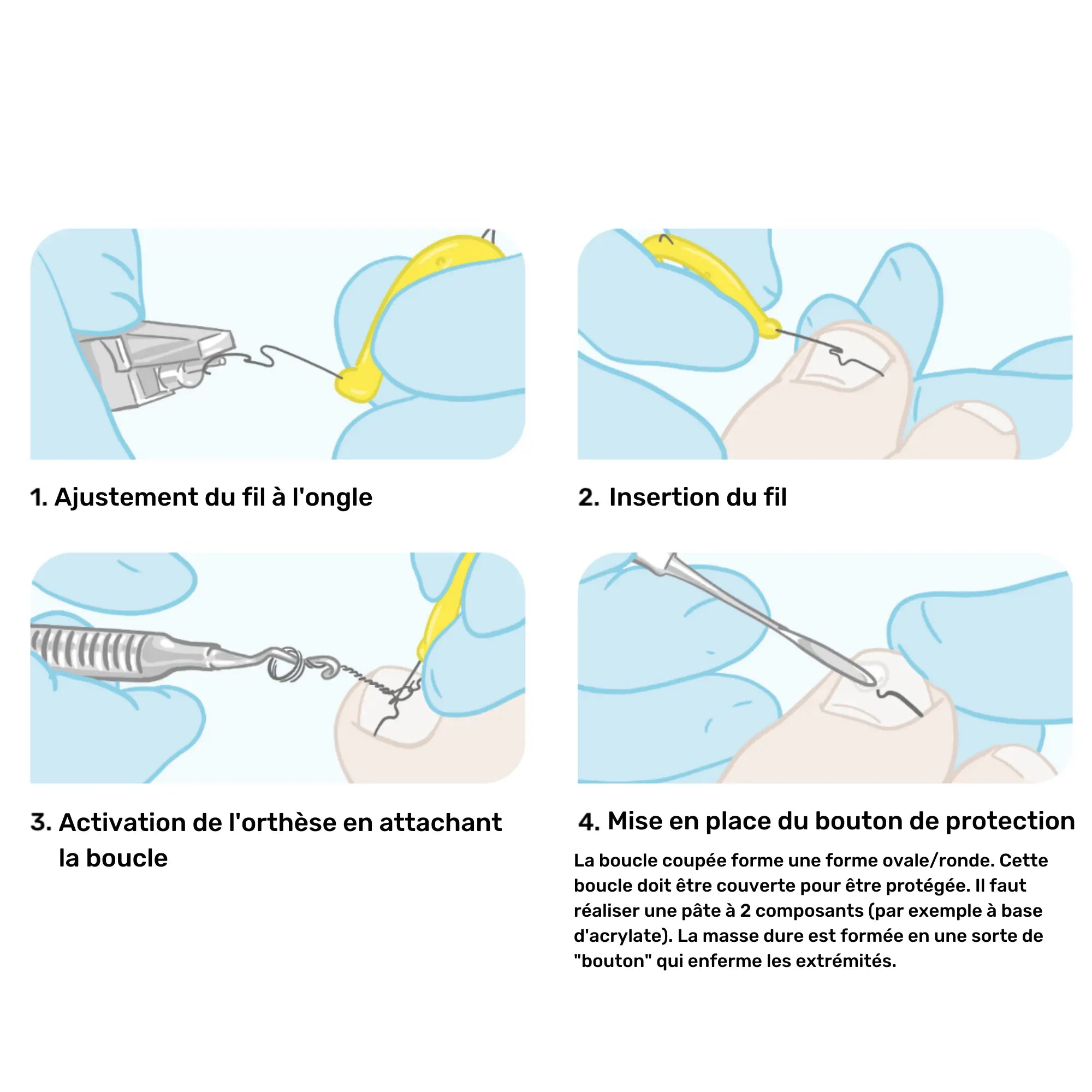 Fils d'orthonyxie Ortogrip - Avec applicateur - Ruck - My Podologie